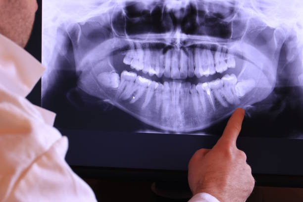 Best Emergency Dental Surgery in Biscayne Park, FL